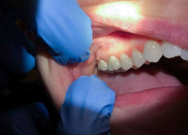 Best Same-Day Emergency Dentist in Camp Hill, PA